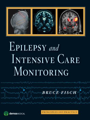cover image of Epilepsy and Intensive Care Monitoring